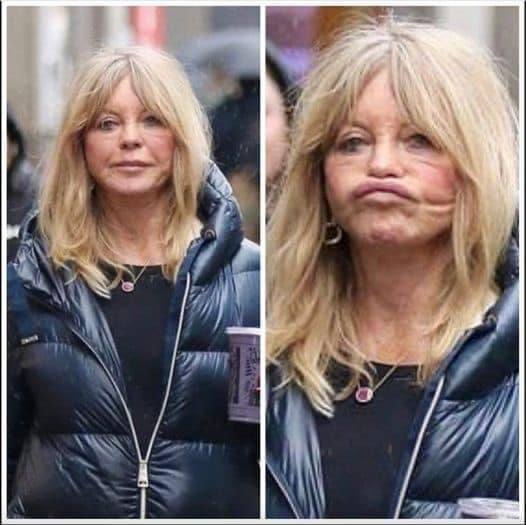 Unsuccessful Facelift Ruins 77-Year-Old Goldie Hawn’s Appearance Dramatically